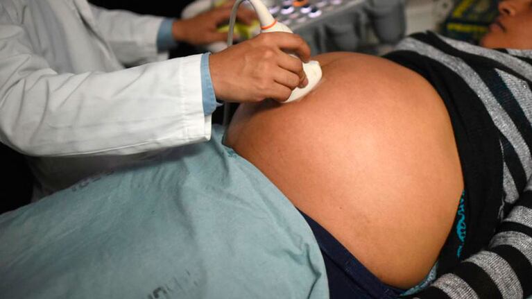 La mujer embarazada con zika está bajo supervisión médica.