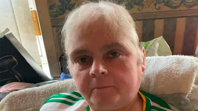 La mujer falleció después de que le amputaran el brazo. Foto: Keneddy News - The Sun