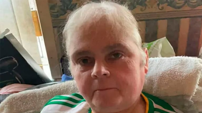 La mujer falleció después de que le amputaran el brazo. Foto: Keneddy News - The Sun
