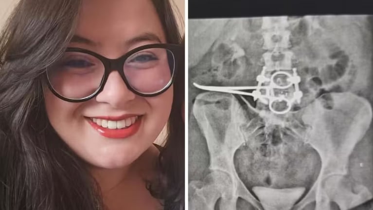 La mujer fue operada cuatro veces por el error médico.