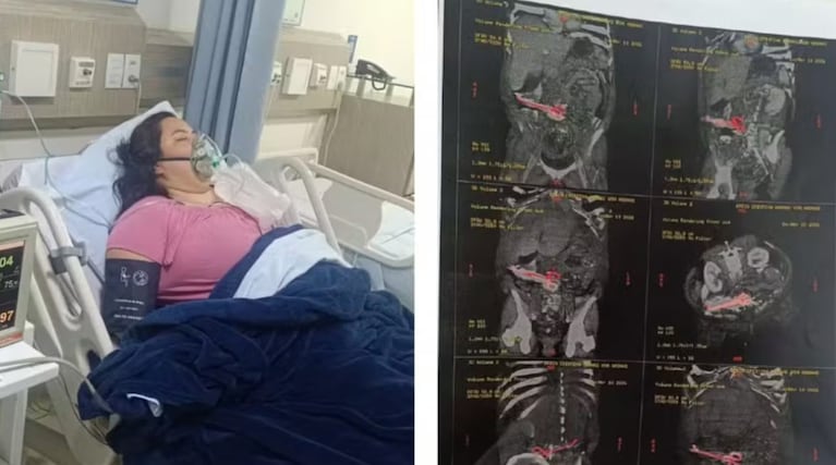 La mujer fue operada cuatro veces por el error médico.