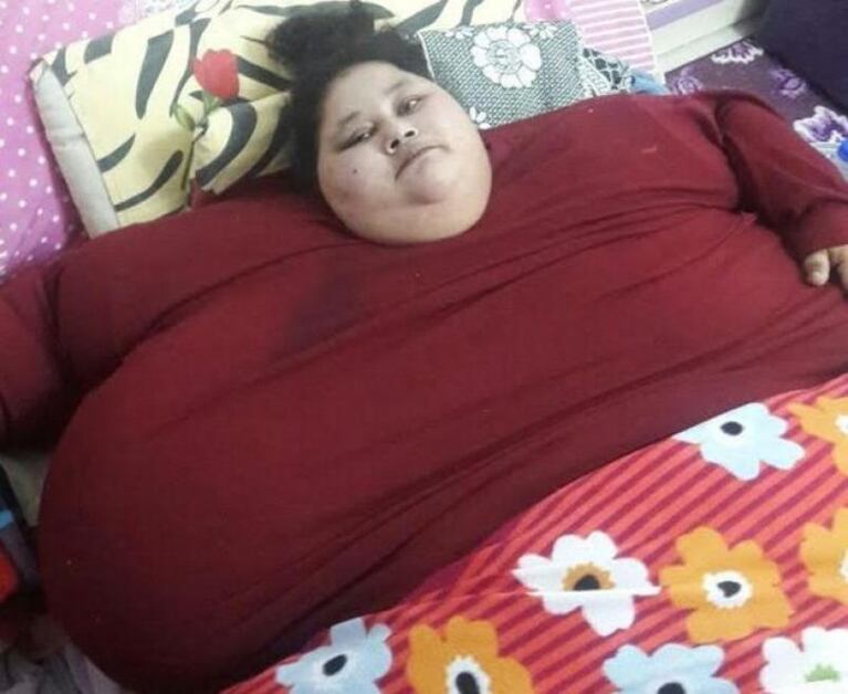 La mujer más obesa del mundo fue operada en la India