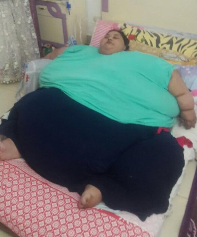 La mujer más obesa del mundo no pierde las esperanzas