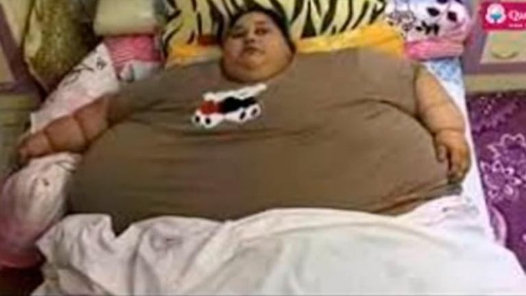 La mujer más obesa del mundo no pierde las esperanzas