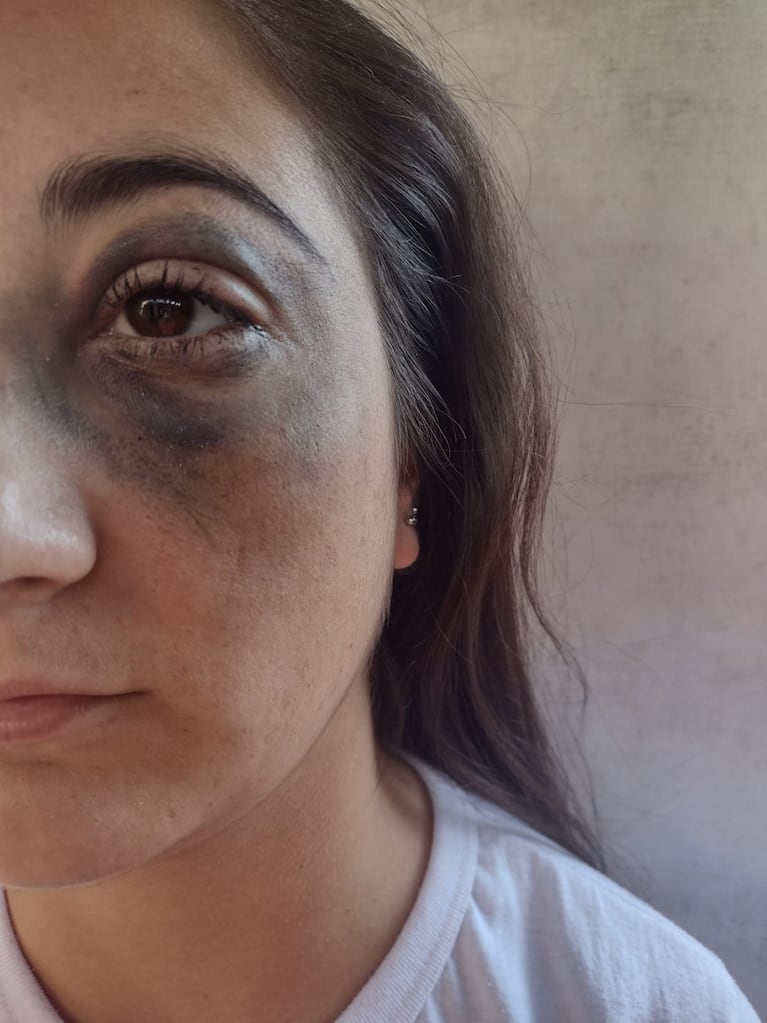 La mujer mostró cómo quedó su rostro tras la agresión del policía.