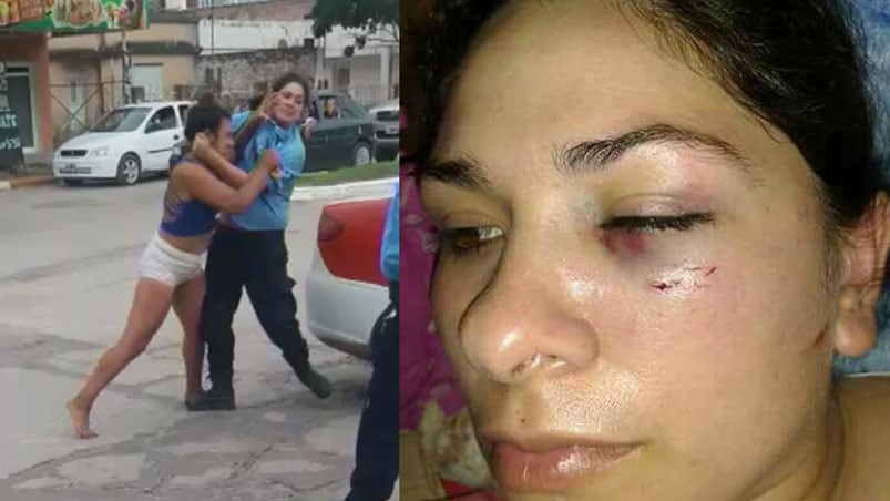 La mujer policía mostró como le quedó el rostro tras el ataque.