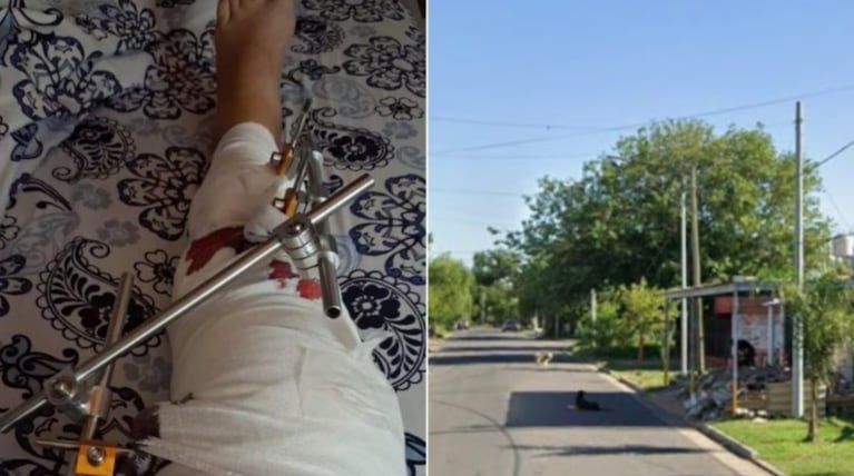 La mujer sufrió una grave fractura.