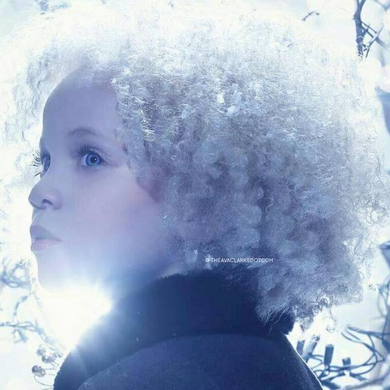 La niña albina de raza negra que triunfa en las pasarelas