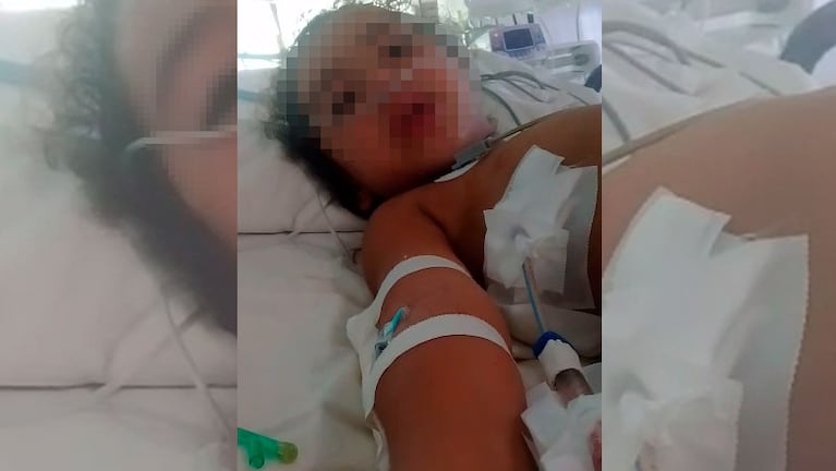 La niña lucha por su vida en el Hospital Misericordia.