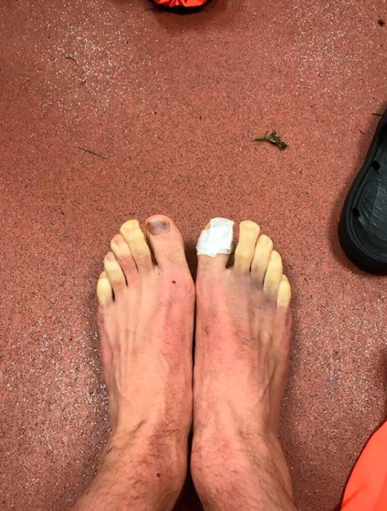 La ola polar congeló los dedos de los pies del jugador Adam Lallana
