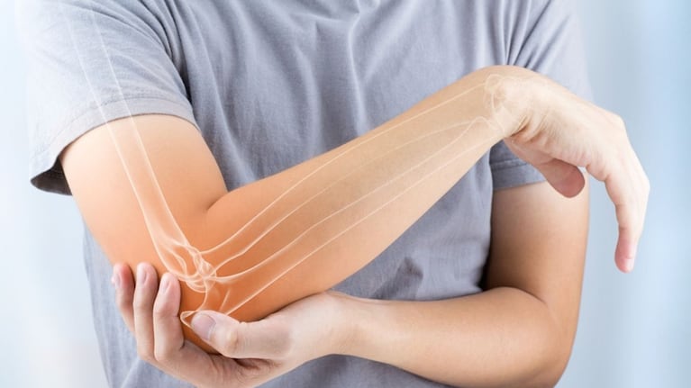 La osteoporosis debilita los huesos.