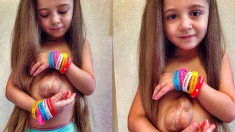 La pequeña nació con la enfermedad llamada Pentalogía de Cantrell (o síndrome toraco abdominal).