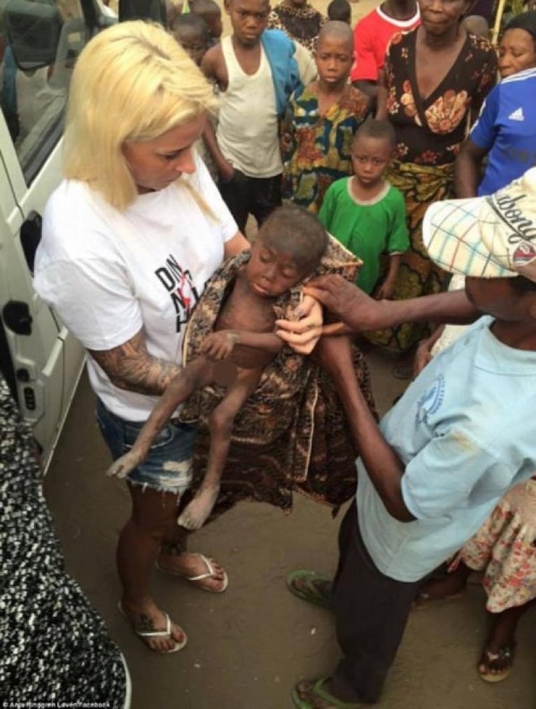 La recuperación de un niño nigeriano desnutrido sorprendió al mundo
