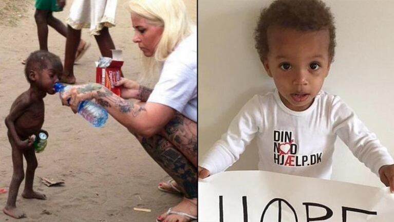 La recuperación de un niño nigeriano desnutrido sorprendió al mundo