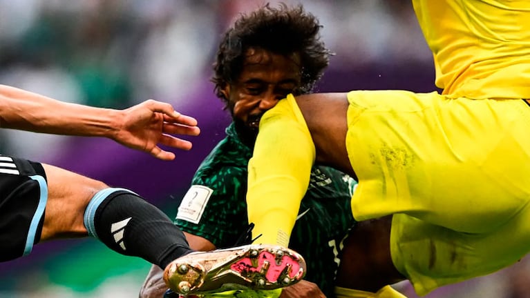La salud del jugador de Arabia Saudita que se golpeó la cara en el partido contra Argentina