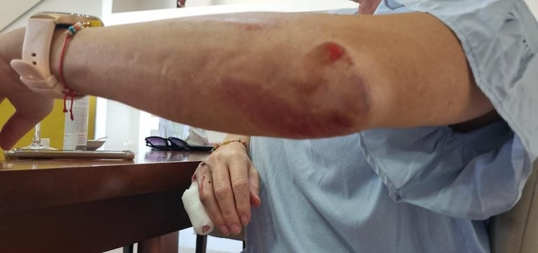 La tiraron de la bici para robarle y terminó con cortes y heridas: el violento video