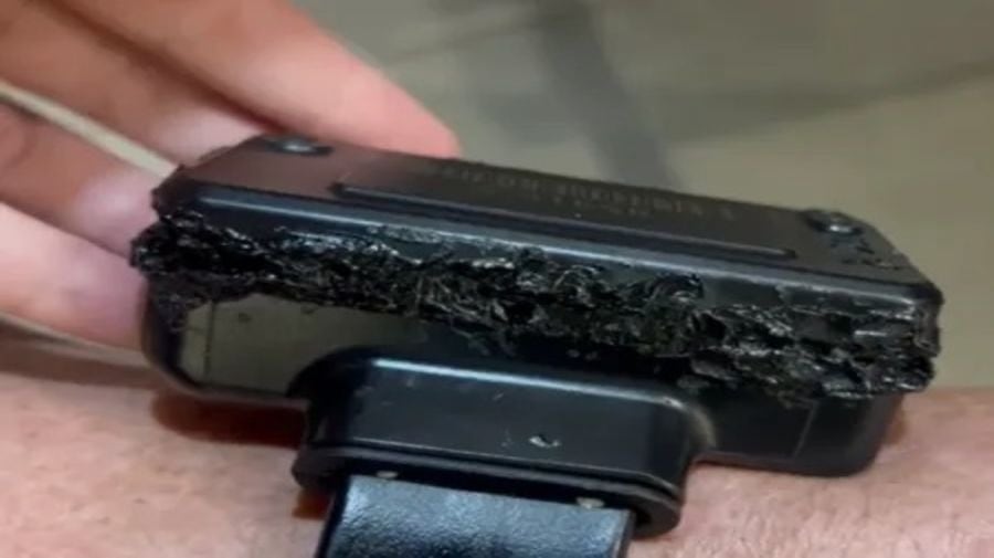 La tobillera de Bolsonaro.