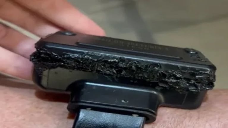 La tobillera de Bolsonaro.