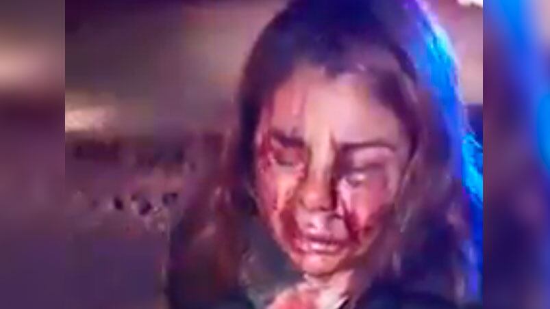 La víctima fue auxiliada por automovilistas que pasaban por el lugar.