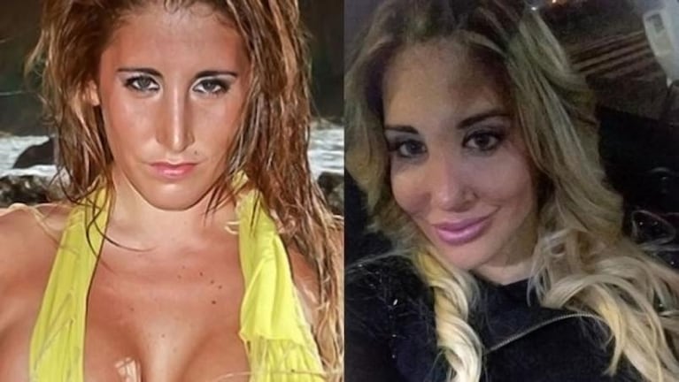 Las famosas después de las cirugías 