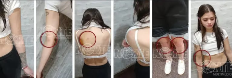 Las fotos de las lesiones que tenía la joven acusada de matar a su novio en Chaco: qué dice la pericia
