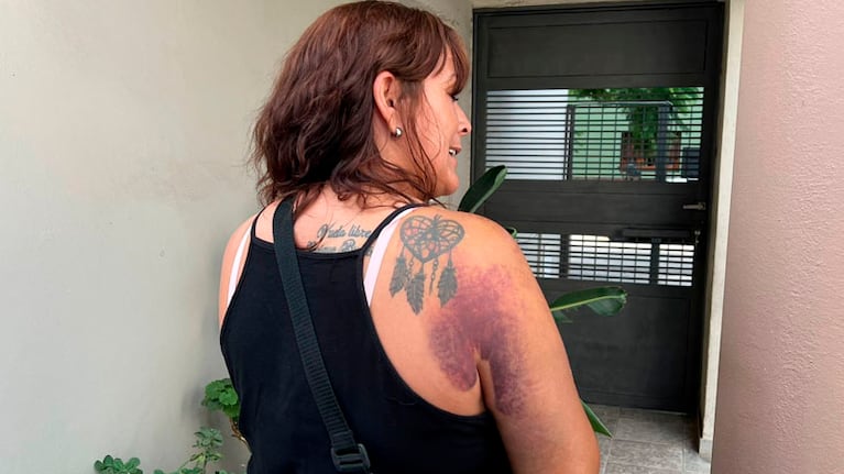 Las heridas que le dejó el violento ataque. Foto: Mateo Lago/ElDoce.