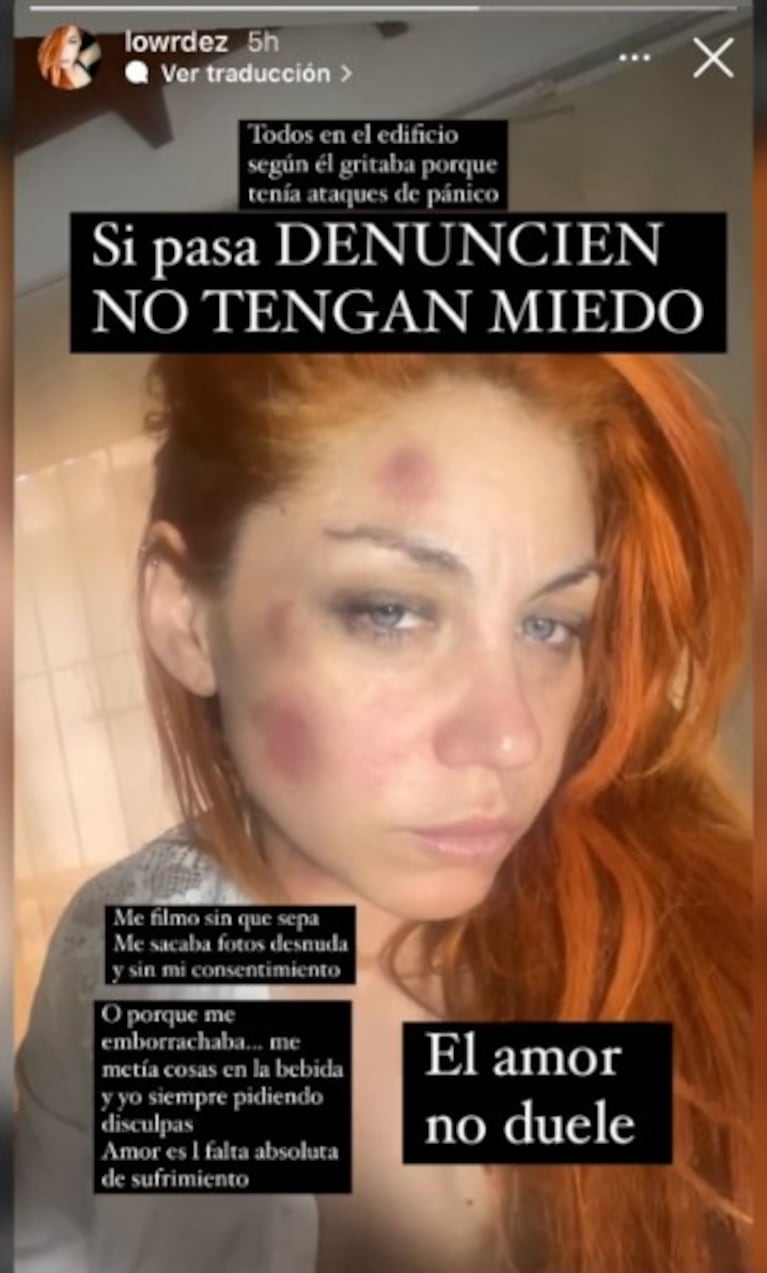 Las imágenes que publicó Lowrdes tiempo atrás.