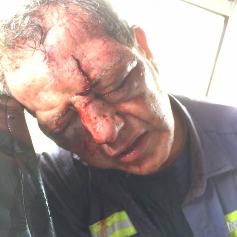 Las impactantes fotos del maquinista linchado en Malagueño