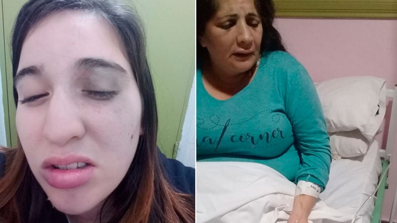 Las mujeres agredidas, muy lastimadas en el hospital de Vicuña Mackenna. 