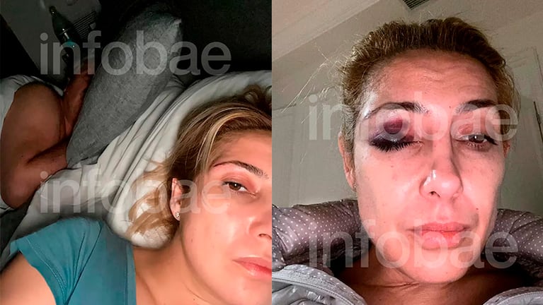 Las nuevas imágenes de Fabiola Yañez con golpes en el rostro.