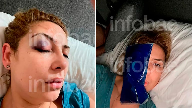 Las nuevas imágenes de Fabiola Yañez con golpes en el rostro.