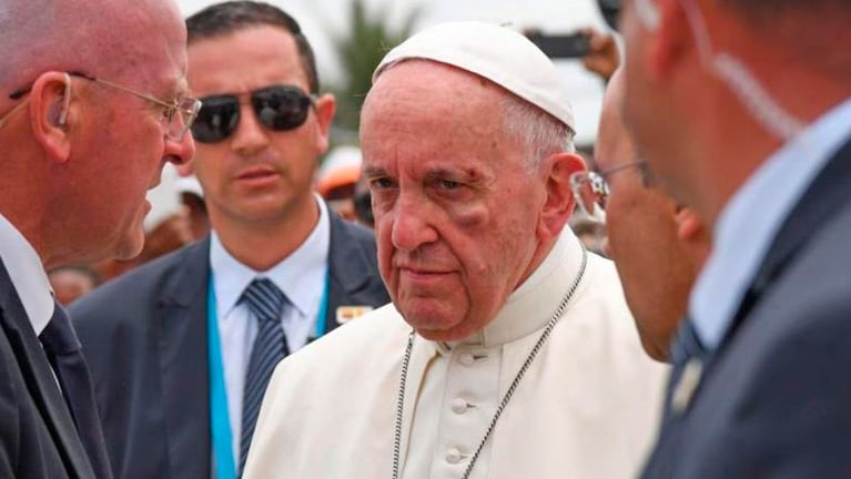 Las secuelas del golpe se ven en el rostro de Francisco. 