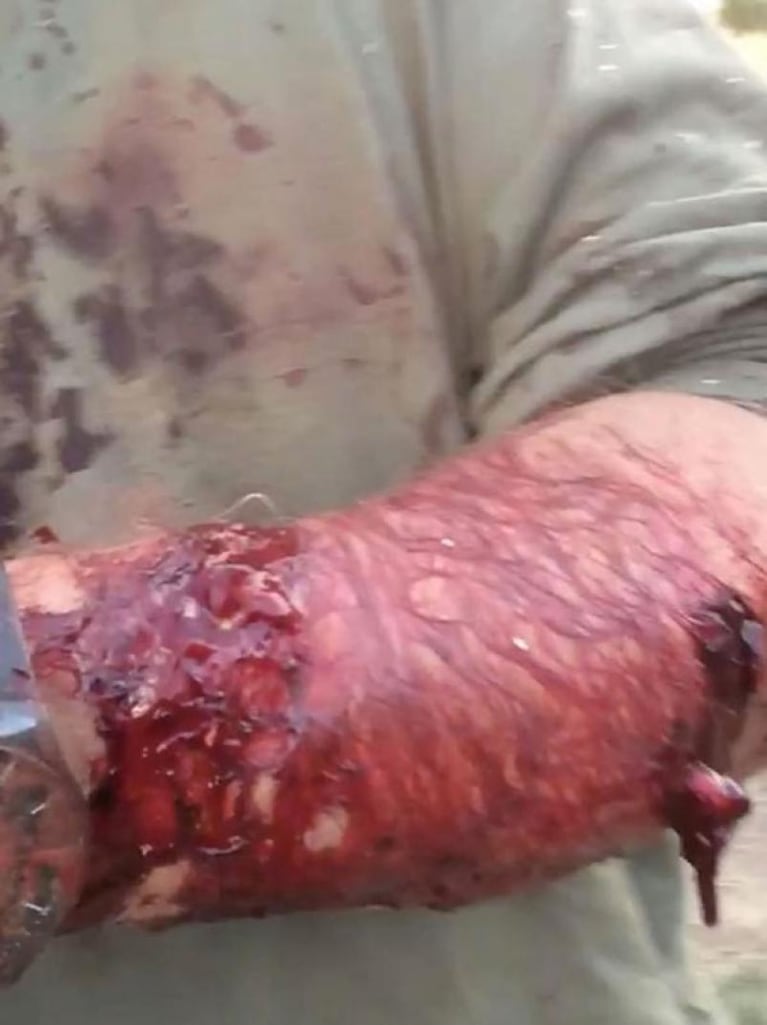 Las terribles heridas del cazador que fue atacado por una osa