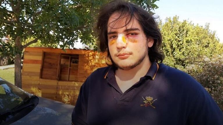 Lautaro Insúa fue brutalmente agredido en diciembre del año pasado.