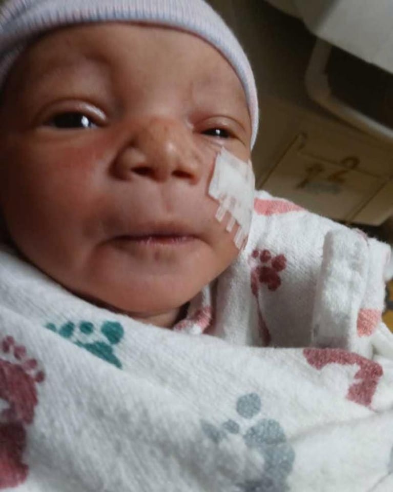 Le cortaron la cara a una beba en la cesárea: qué dijeron los médicos 