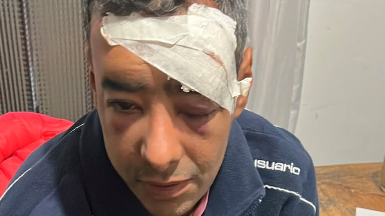 Le dieron una paliza para robarle la bici.