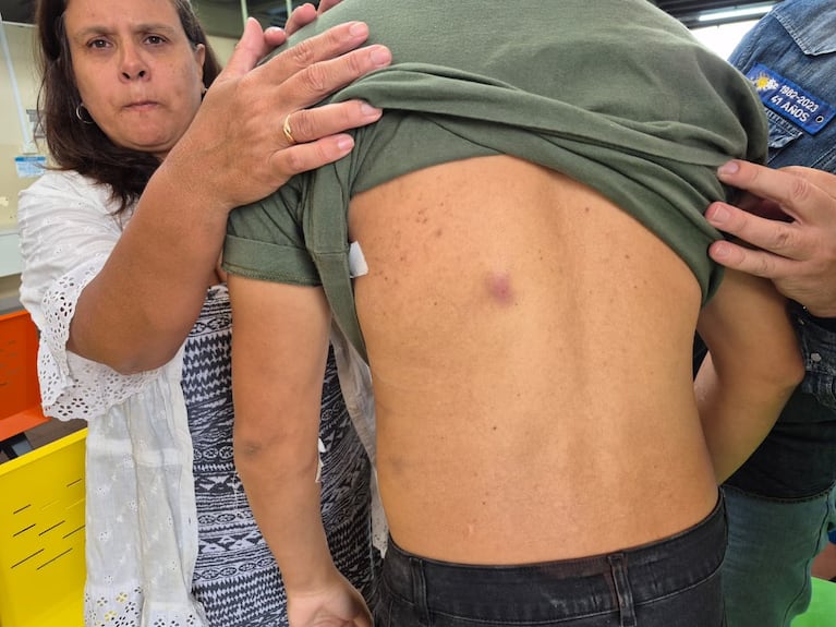 Le dispararon para robarle el celular y mostró en vivo la bala alojada en su espalda