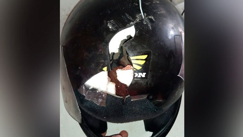 Le hicieron tres puntos en la cabeza y el casco quedó destrozado.