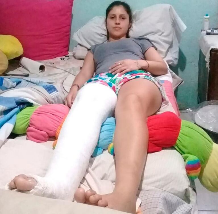 Le quebraron la pierna para robarle el celular y quedó postrada en una cama