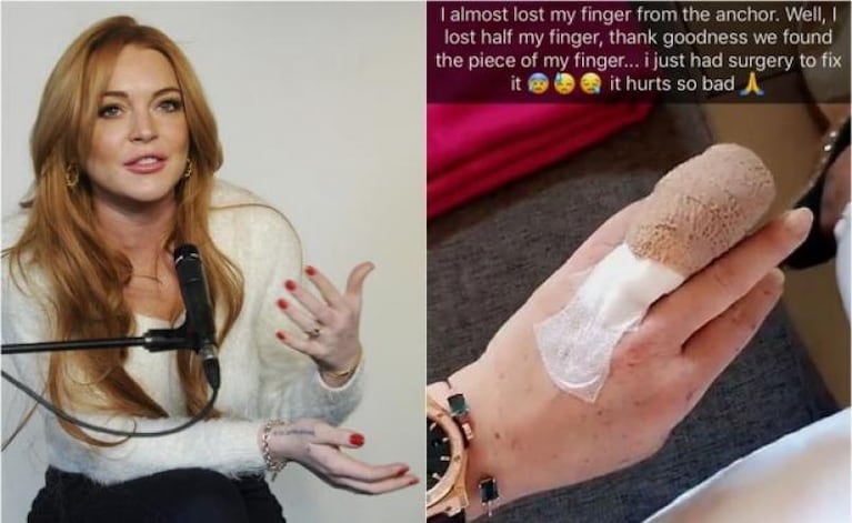 Lindsay Lohan casi pierde un dedo de la mano