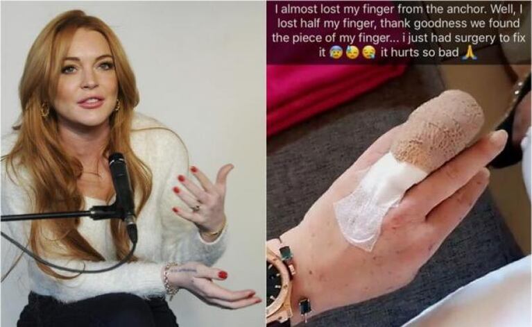 Lindsay Lohan casi pierde un dedo de la mano