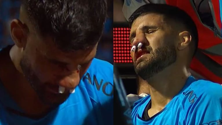 Lisandro López sufrió un duro golpe en el partido ante Atlético Tucumán.