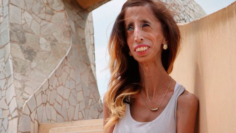 Lizzie Velasquez lucha en contra del bullying.