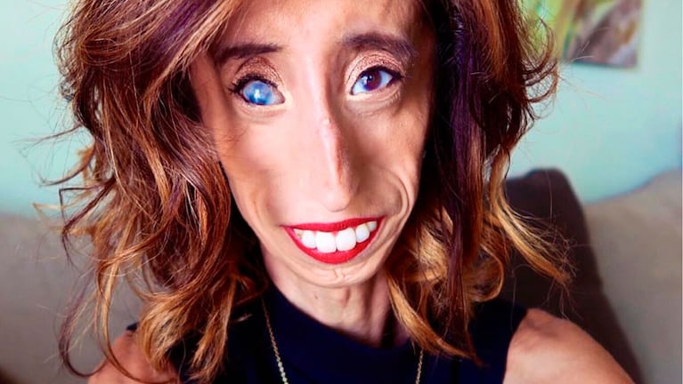 Lizzie Velasquez respondió a las críticas ofensivas.