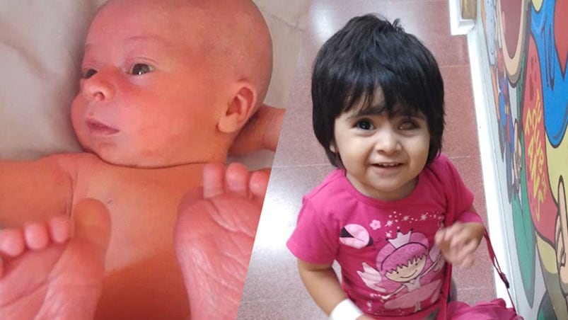 Los bebés cordobeses padecen Retinoblastoma bilateral.