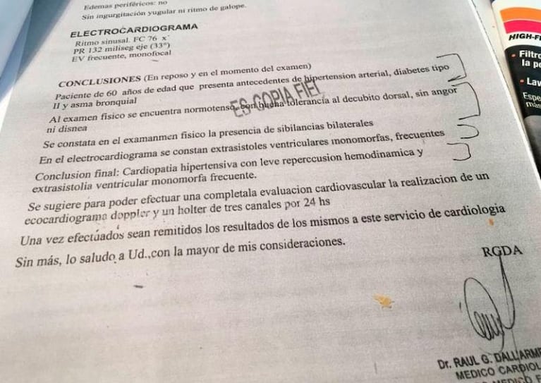 Los detalles de la pericia médica de Lázaro Báez