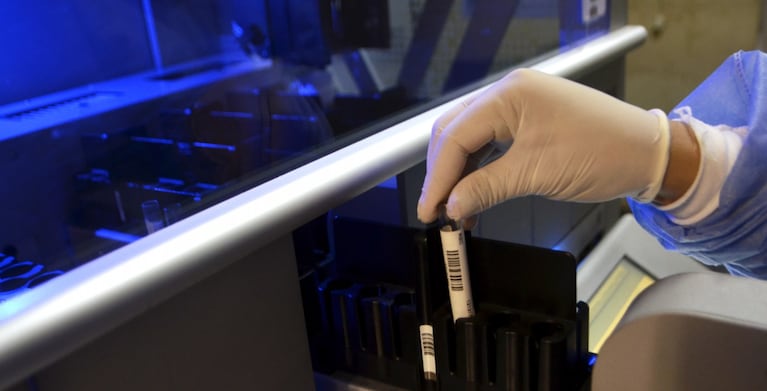 Los grupos sanguíneos raros aparecen en menos de una persona cada mil, y en algunos casos en uno entre millones.