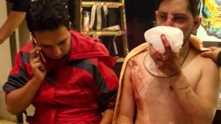 Los hinchas del Jorge Wilstermann heridos tras la emboscada en Retiro.