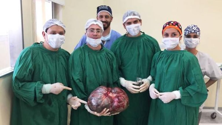 Los médicos posaron para la foto junto al tumor de 15 kilos.