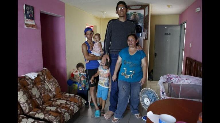 Los pies más grandes del mundo están en Venezuela